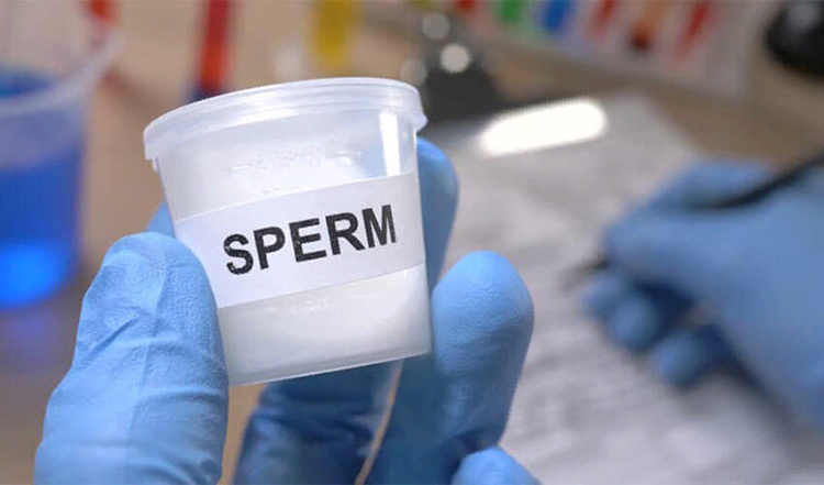 Sperm Testi Nasıl Verilir? - Nova Fertil