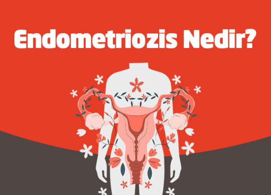 Endometriozis Nedir? - Novafertil