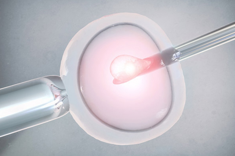Tüp Bebek (IVF) Tedavisi Hangi Durumlarda Tercih Edilir? - Novafertil